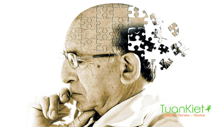 Alzheimer là bệnh gì?