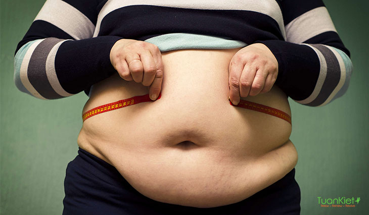 Bệnh béo phì là một trong những dấu hiệu của bệnh buồng trứng đa nang
