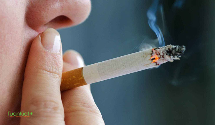 Hút thuốc lá là một trong những nguyên nhân gây nên bạch sản