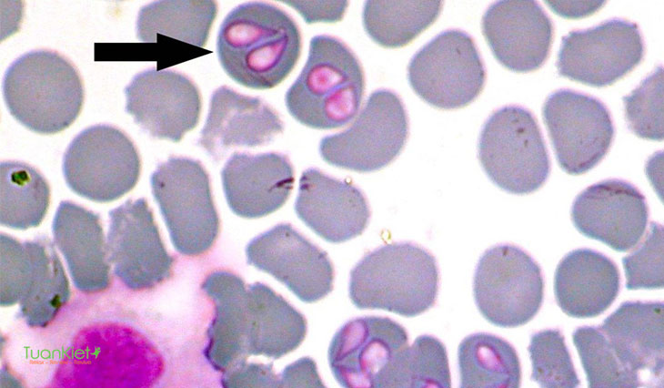 Ký sinh trùng babesia microti ký sinh trong hồng cầu