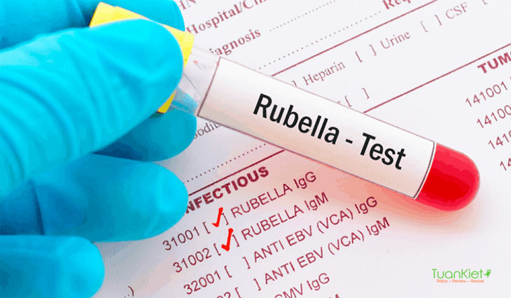 Việc xét nghiệm Rubella là điều cần thiết